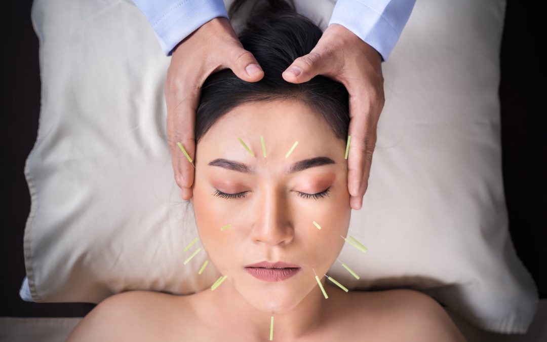 The Benefits of Gaining Your Certification Through Dry Needling Training Texas