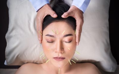 The Benefits of Gaining Your Certification Through Dry Needling Training Texas