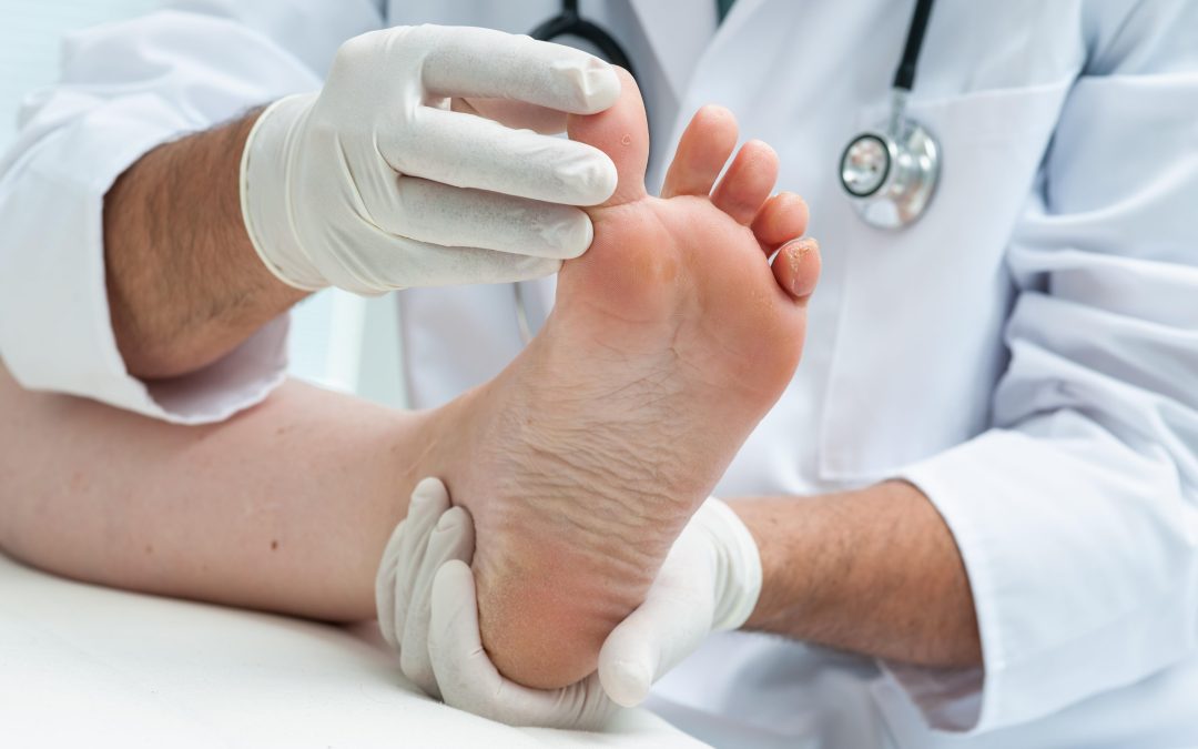 Simple Home Remedies That Work for Ingrown Toenail Treatment in Chesapeake, VA Residents