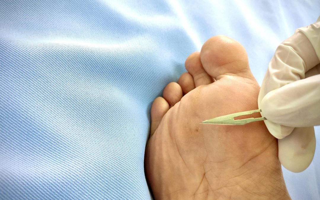 Safe and Lasting Relief with Achilles Tendon Pain Treatment in Virginia Beach, VA
