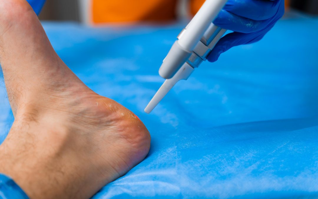 Fast Recovery Solutions for Ankle Sprain Treatment in Culpeper, VA That Really Work
