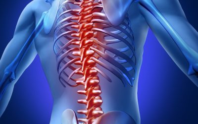 Restore Daily Activity with Kyphoplasty in Warrenton, VA, Advanced Back Care