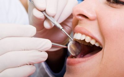 Restore Your Smile’s Beauty and Function with Veneers in Pasco, WA Treatments